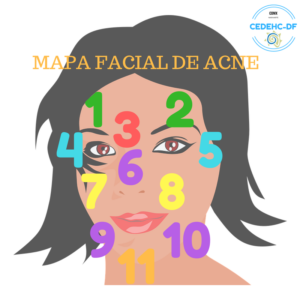 acne facial